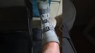 NHS WORTHING HOSPITAL2ND TO NONE AIRCAST BOOT ANKLE [upl. by Azer315]