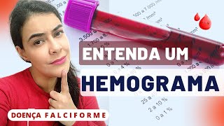 🩸Como ler um HEMOGRAMA completo  com DICAS para quem usa HIDROXIURÉIA  Anemia Falciforme [upl. by Toblat]