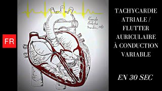 Arythmies Animation cardiaque et ECG  Flutter Auriculaire à Conduction Variable Shorts [upl. by Mairb995]