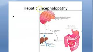 Medicine 0886 HEPATIC ENCEPHALOPATHY Ammonia GABA Octopamine Mercaptans Lactulose Rifaximin Portal [upl. by Jinny274]