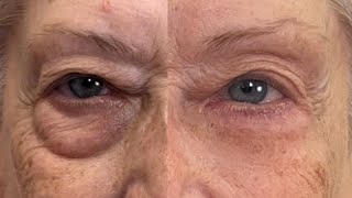 Get Rid of Eye Bags Instantly Eliminate Puffiness and Darkness 🚨 Fierce Aging with Nikol Johnson [upl. by Jase470]