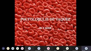 Polyglobulie de vaquez [upl. by Adali]