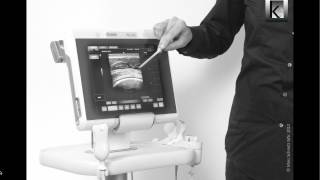 Musculoskeletal ultrasound in physiotherapy part 2 [upl. by Vandervelde]