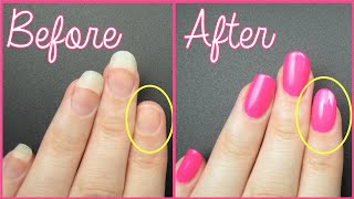 FIX A BROKEN NAIL FAST [upl. by Mera]