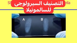 التصنيف السيرولوجى للسالمونيلا Salmonella Serotyping [upl. by Tnecniv]