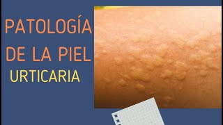 6 URTICARIA [upl. by Norris]