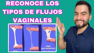 LOS TIPOS DE FLUJOS VAGINALES  FLUJOS VAGINALES  DR DAVID CAMPOS [upl. by Silado962]