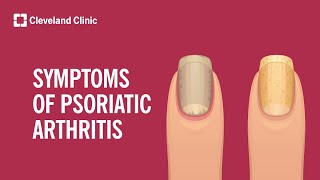 7 Signs of Psoriatic Arthritis [upl. by Ares]