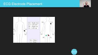 ECG Electrode Placement  Australian Paramedical College [upl. by Sinnaiy]