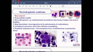 Pathology WBC 3 [upl. by Staal]