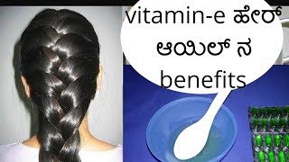 vitamin e ಹೇರ್ ಆಯಿಲ್ ಉಪಯೋಗಿಸುವುದು ಹೇಗೆhair tips for growing long hair [upl. by Obrien]