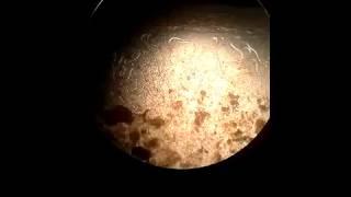 Aelurostrongylus abstrussus in cats Cat lungworm [upl. by Yeleek391]