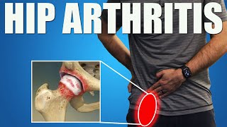 HIP OSTEOARTHRITIS BEST Exercises Stretches amp Advice for Hip amp Groin Pain Relief [upl. by Cozmo118]