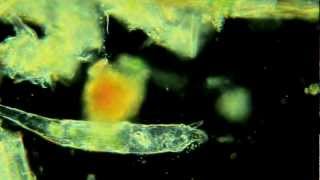 Rotifers Are Awesome [upl. by Asilim332]