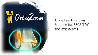 Ankle Fracture dislocation  viva practice for FRCS TampO [upl. by Karalee910]