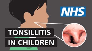 Tonsillitis in children Symptoms and treatment  NHS [upl. by Cresida]