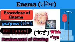 Enema in hindi एनिमा Enema ki procedureprocesspurpose of enemaUses Fundamentals of Nursing [upl. by Manas]