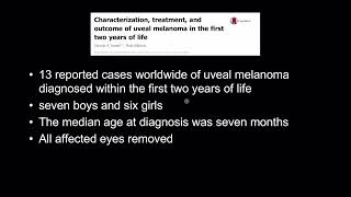 An ocular melanoma diagnosis in childhood [upl. by Akered]