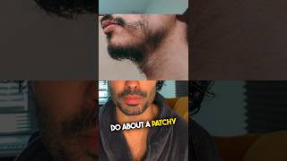 How To Fix A Patchy Beard beard mensgrooming [upl. by Phina]