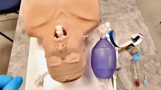 Supraglottic Airway with Explanation [upl. by Kcira]