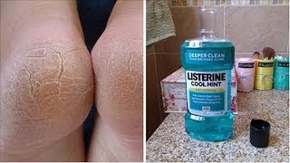 10 Amazing Uses For Listerine That Every Woman Should Know [upl. by Woodrow]