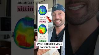 What exercise does to your brain 🧠 medical medtok fittok gym gymtok longevity [upl. by Eile]