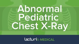 Abnormal Chest Findings in Pediatric Radiology [upl. by Edwine]