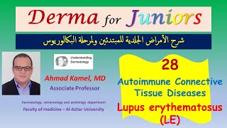 028 Lupus Erythematosus LE Autoimmune Connective tissue diseases [upl. by Oneill]