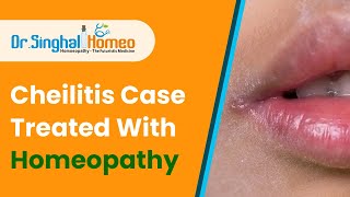 What is Cheilitis  and Homeopathic Treatment for Cheilitis  Dr Singhal Homeo Chandigarh [upl. by Melisandra]