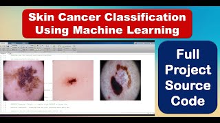 Skin Cancer Classification Using Machine Learning  Skin Cancer Detection Using Matlab Code [upl. by Aeht506]