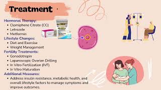 Understanding Polycystic Ovarian Syndrome [upl. by Gennaro3]