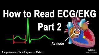 How to Read ECGEKG Part 2 Animation [upl. by Symons280]