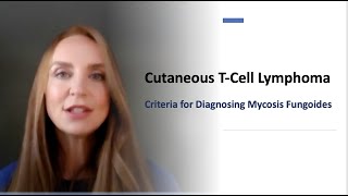 Criteria to Diagnose Mycosis Fungoides Chapter 1 [upl. by Alair711]