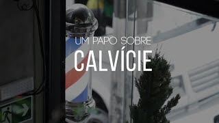 Um papo reto sobre calvície perguntas sinceras [upl. by Ermey244]