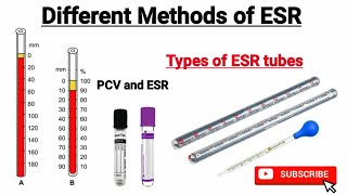 ESR test in hindi  Different methods of estimating ESR  ESR by Wintrobe and westergren Method [upl. by Nairadas652]