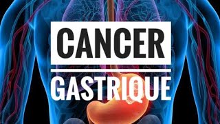 Cancer Gastrique  partie 01 Anatomopathologie [upl. by Marela]