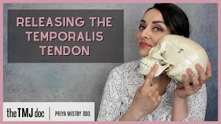 Releasing the Temporalis Tendon  Priya Mistry DDS the TMJ doc temporaltendonitis tmjd tmj [upl. by Adyela]