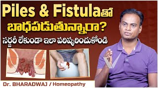 పైల్స్ కు సర్జరీ లేకుండా పరిష్కారం  Piles Treatment at Home in Telugu  Fissure  Vikram Tv Health [upl. by Ewer712]