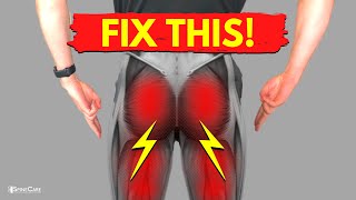 How to Relieve Sciatica Pain in BOTH LEGS [upl. by Bonnibelle]