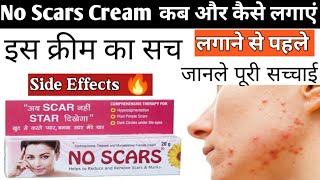 No Scars Cream कब लगाए और कब लगाना बंद करे No Scars क्रीम Uses  No Scars Cream side effects [upl. by Meerak]