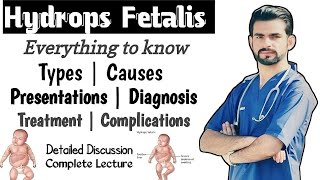 Hydrops Fetalis  causes types management complications [upl. by Ydur]