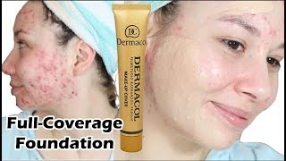 😲 FOUNDATION THAT CAN COVER ACNE  Dermacol Foundation [upl. by Ob]