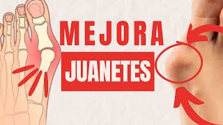 ¿JUANETES Mejóralos con estos ejercicios [upl. by Nellahs]