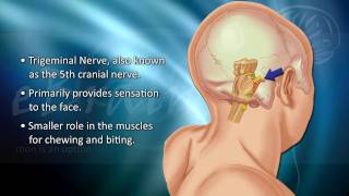 Understanding Trigeminal Neuralgia  eBrainMDcom [upl. by Pish]