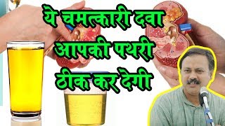 Rajiv Dixit  पथरी का ऐसा घरेलू इलाज आपने पहले नहीं देखा होगा Stone Treatment by Rajiv Dixit [upl. by Viva]