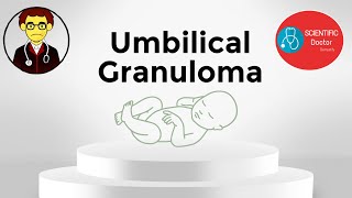 Umbilical Granuloma  What is it   Simple Home Remedy  Red swelling in Umbilicus [upl. by Anatlus933]