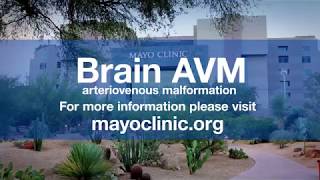 Dr Bernard Bendok Arteriovenous Malformation  Brain AVM [upl. by Aloivaf]