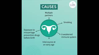 Things You Need to Know About Cervical Cancer  CARE Hospitals [upl. by Sontag]