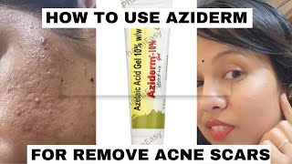 aziderm gel review honest reviewhow to use azelaic acid for acne amp acne marksacnetreatment viral [upl. by Marou895]