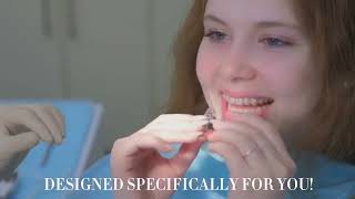 Active Aligners  Transparent Orthodontic Braces in South Africa [upl. by Boonie706]